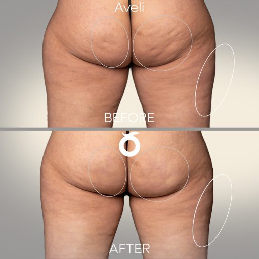 aveli-solee-cosmetic