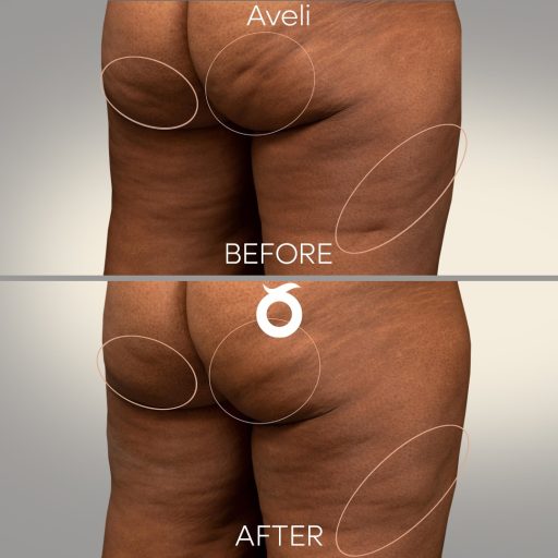aveli-solee