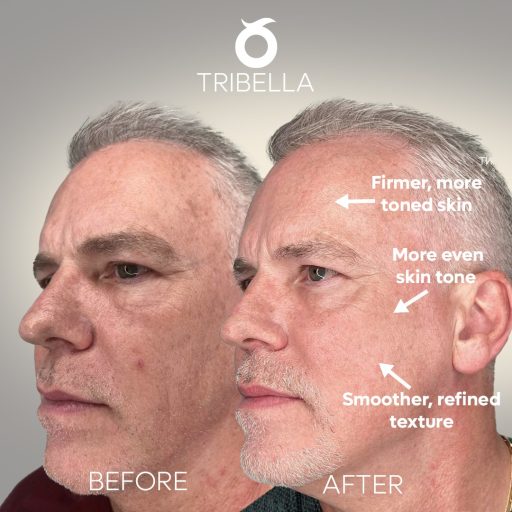 tribella-solee-cosmetic